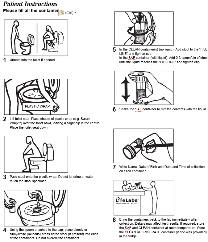 An illustrated eight-step patient instruction sheet for collecting stool samples at home and returning them to the laboratory.